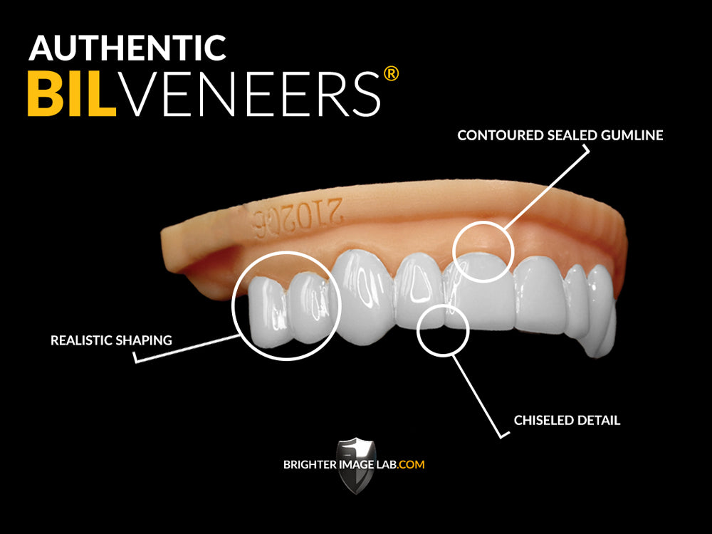 BIL Veneers® (Test Copy)