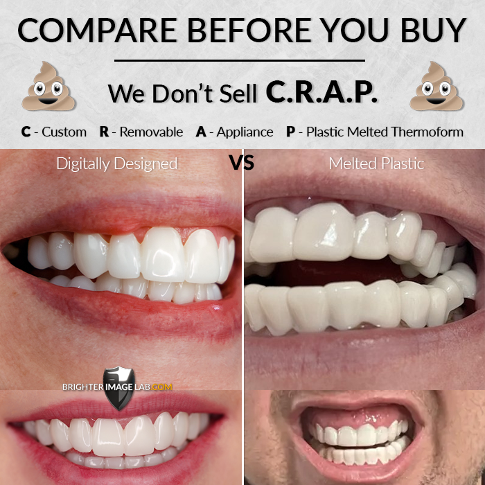 PressOn Veneers™