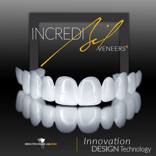IncrediBIL Veneers®