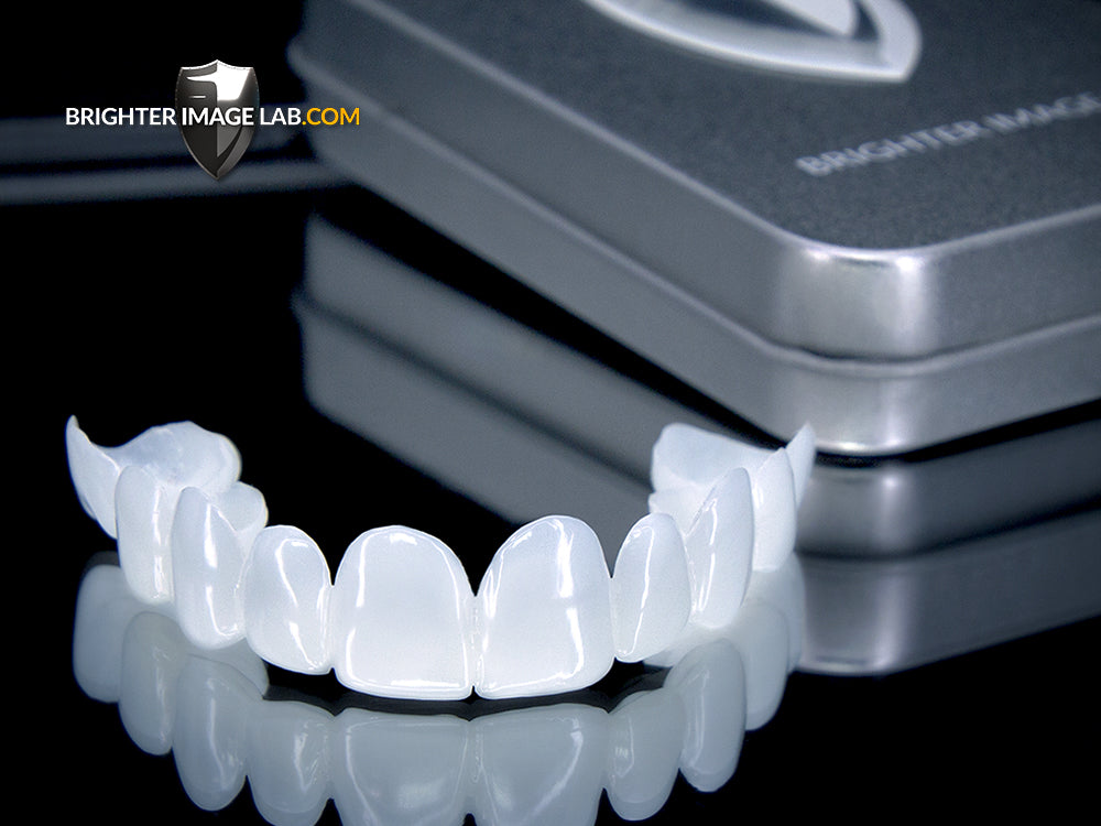 IncrediBIL Veneers® (Test Copy)