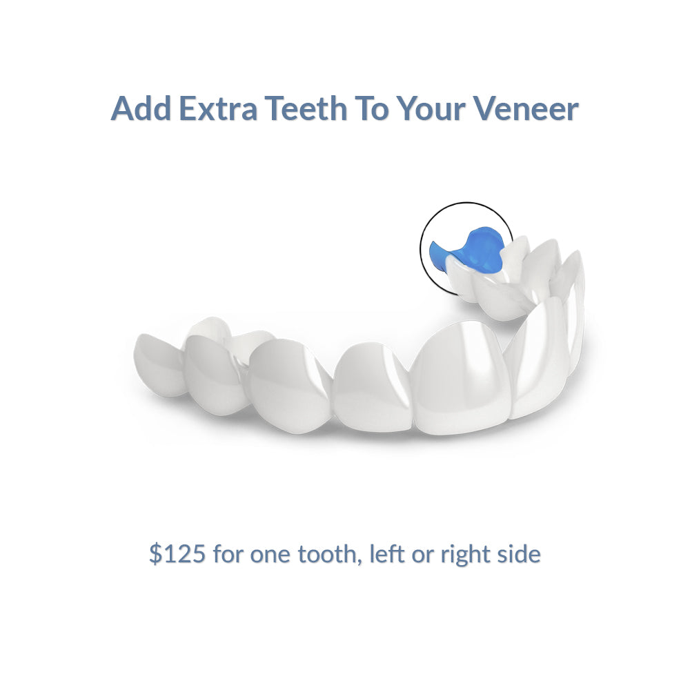 Add Extra Teeth To Your Veneer