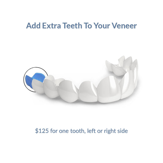Add Extra Teeth To Your Veneer