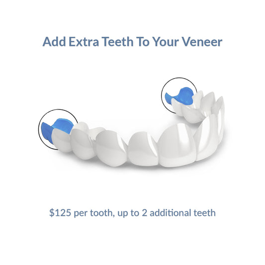 Add Extra Teeth To Your Veneer