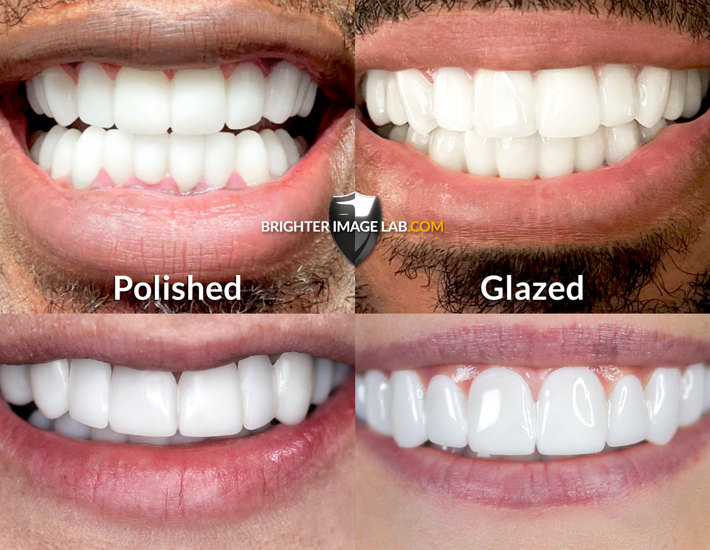 DuraBIL Diamond Glaze