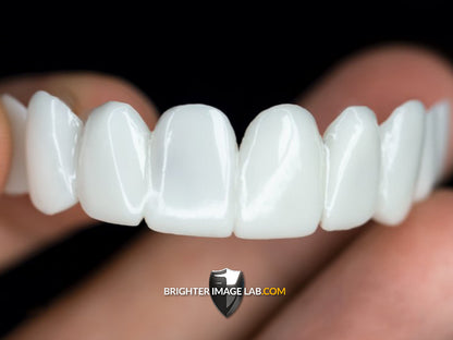 PressOn Veneers™